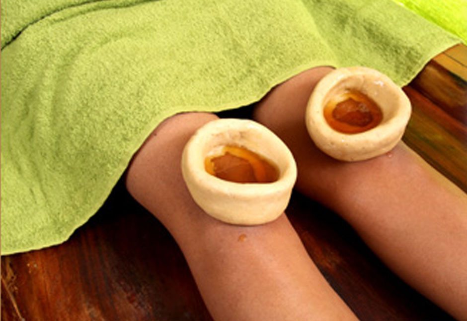 Janu Basti treatment with warm medicated oil retained over both knees